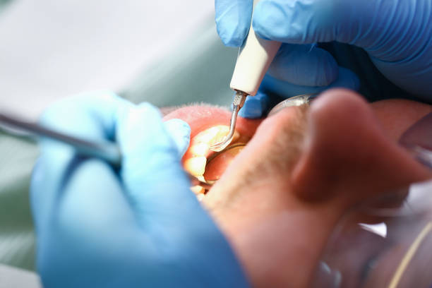 Best Emergency Dental Care for Broken or Chipped Teeth in Ralls, TX